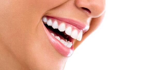 featured image for how at-home whitening treatments burn gums