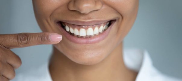Woman showing off bright smile after following habits for healthy teeth.