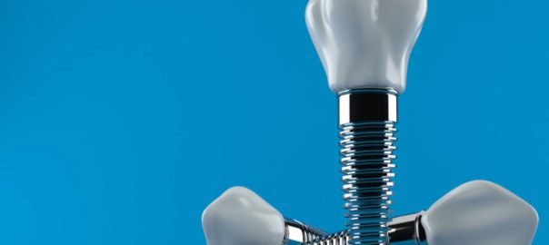 three dental implants on blue background.